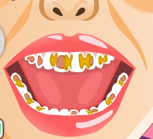 Play Baby Tooth Trouble Game