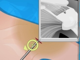 Play Operate Now Shoulder Surgery Game